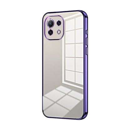 Xiaomi Mi 11 Lite 5G Case - Transparent Plating & Precision Hole Design for Luxury and Protection-buycases.co.uk