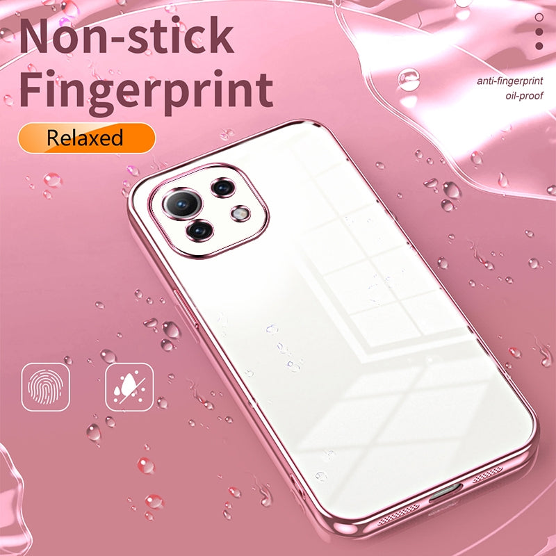 Xiaomi Mi 11 Lite 4G Case - Transparent Plating & Precision Hole Design for Luxury and Protection-buycases.co.uk