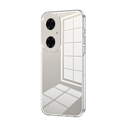 Huawei Maimang 20 Case - Transparent Plating & Precision Hole Design for Luxury and Protection-buycases.co.uk